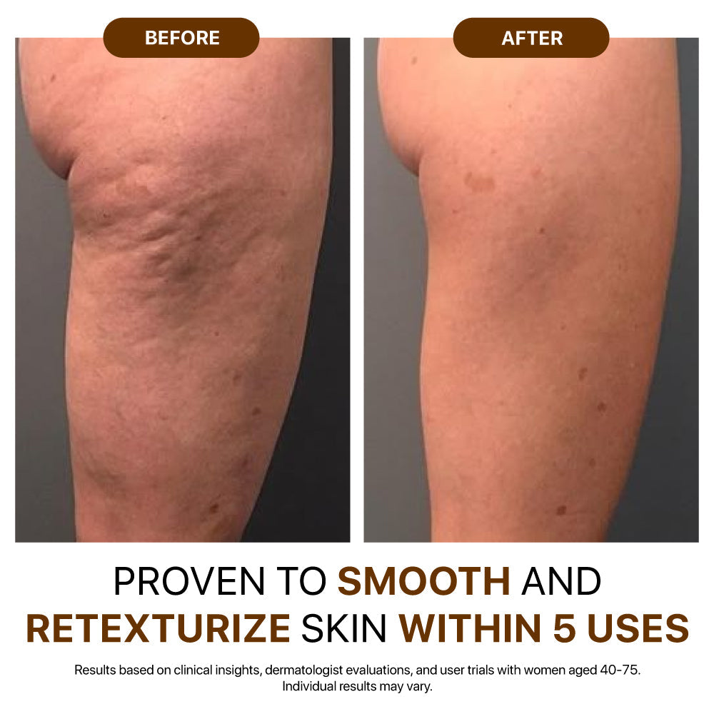 Rediscover confidence with firmer, smoother, radiant skin